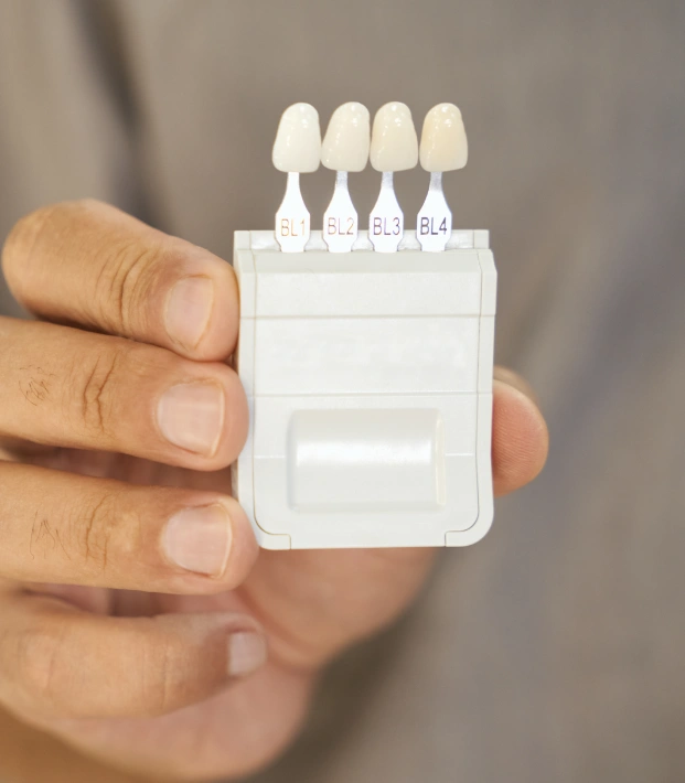 Dental veneers displayed in a dental shade guide